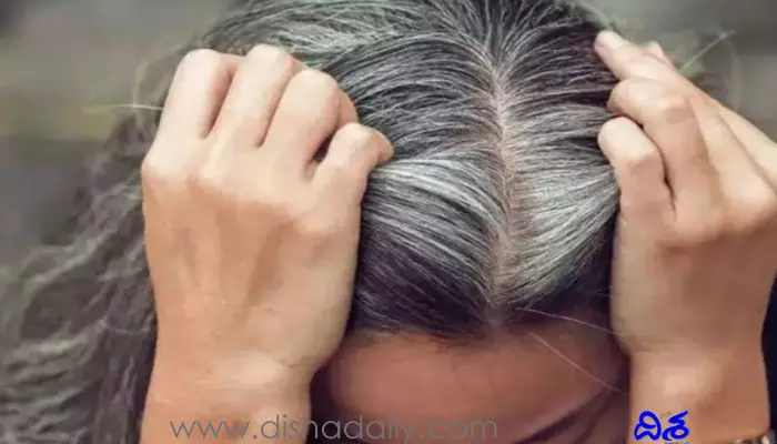 Remedies For White Hair