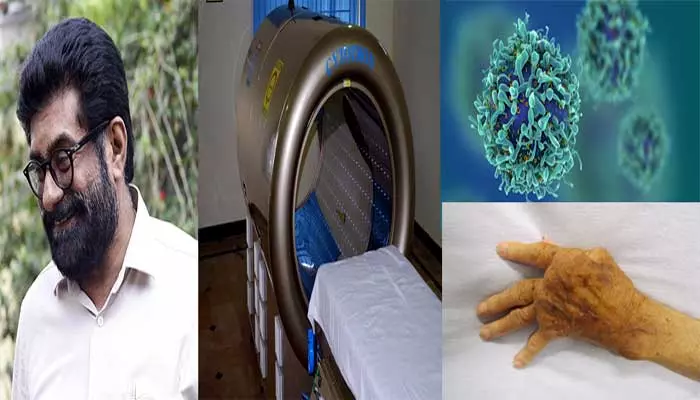 Cancer Treatment: క్యాన్సర్ చికిత్సలో ముందడుగు