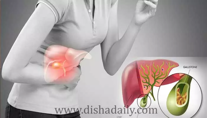 Gallbladder Diet : గాల్ బ్లాడర్ స్టోన్స్‌ ఉంటే గనుక.. ఇవి తినొద్దు !