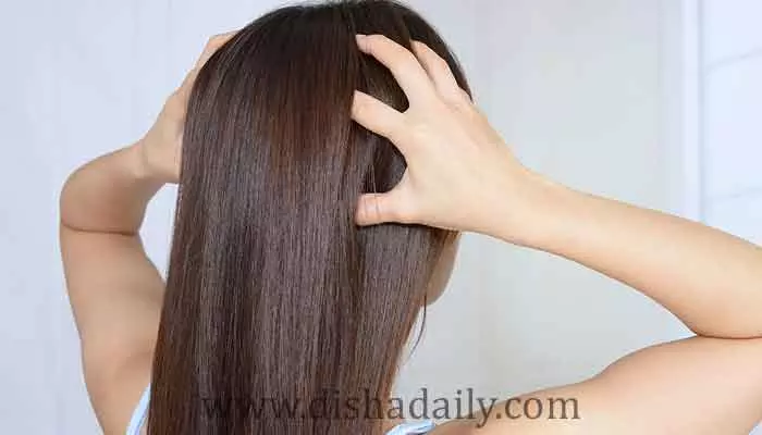 Sensitive Scalp: తల దురదకు చెక్ పెట్టండిలా !