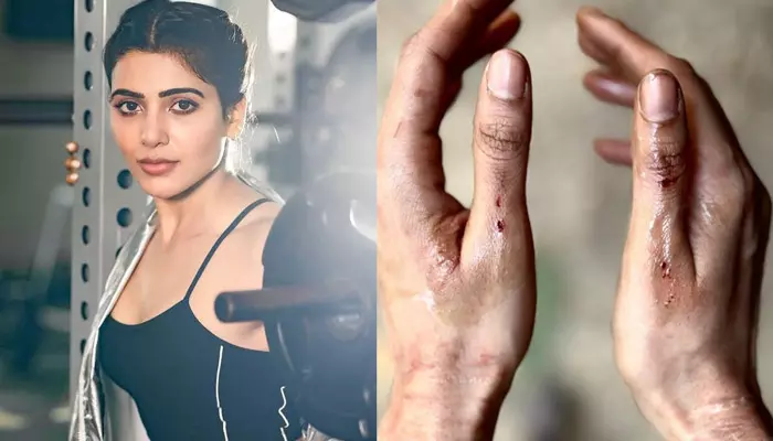 Samantha: గాయపడ్డ సమంత.. రక్తంతో షాకింగ్ పోస్ట్