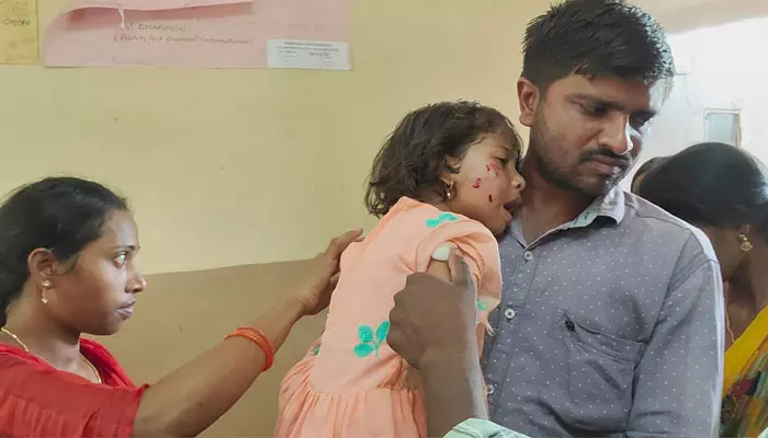 కుక్క దాడిలో నాలుగేళ్ల పాపకు గాయాలు