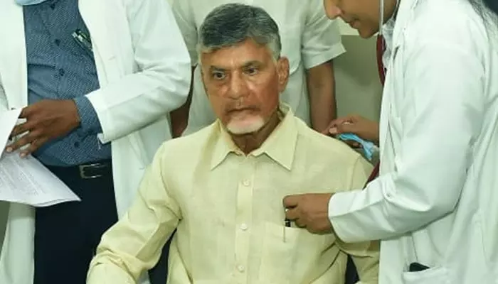 చంద్రబాబు ఆరోగ్యంపై వైద్యుల కీలక ప్రకటన.. స్టెరాయిడ్స్‌పై క్లారిటీ