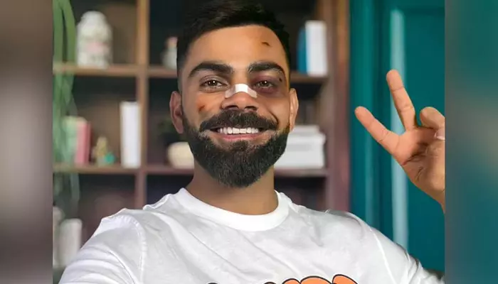 Virat Kohli: ముఖానికి గాయాలు.. ముక్కుపై బ్యాండేజ్.. కోహ్లీకి ఏమైంది..?