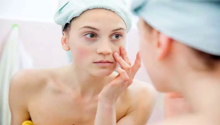 Skin care : చర్మం పై హోం రెమెడీస్ అప్లై చేస్తున్నారా… తస్మాత్ జాగ్రత్త…!