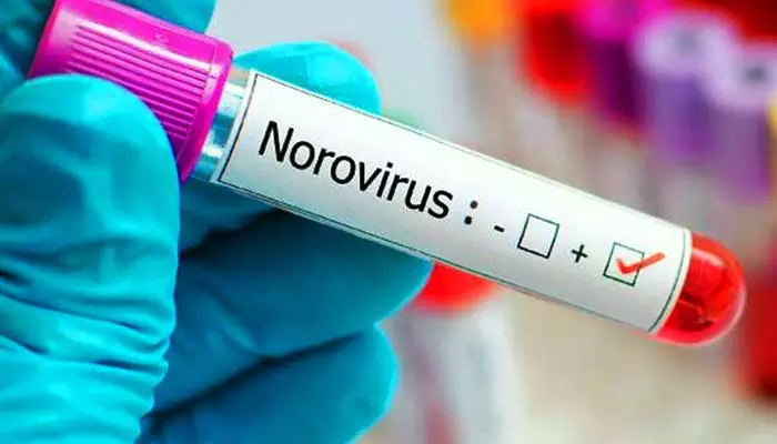 Noro Virus : నోరో వైరస్‌పై హెల్త్ డైరెక్టర్ కీలక అప్డేట్