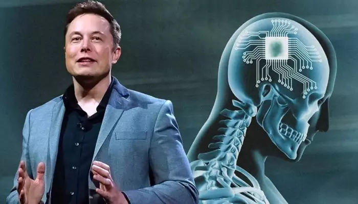 Elon Musk: రెండో మనిషి మెదడులోనూ విజయవంతంగా ఎలక్ట్రానిక్ చిప్.. మస్క్ సంచలన ప్రకటన