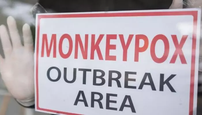 Mpox Outbreak: స్వీడన్‌లో మొదటి మంకీపాక్స్ కేసు నమోదు