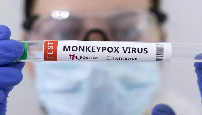 Mpox: పాక్ ఆక్రమిత కశ్మీర్‌లో మంకీపాక్స్ కేసు.. పాకిస్తాన్‌లో నాలుగవది