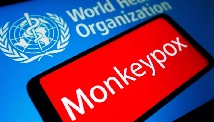 Monkeypox: మంకీపాక్స్‌ కొత్త కొవిడ్ కాదు.. ఎలా నియంత్రించాలో తెలుసు: WHO