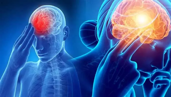 Migraine Headache : మైగ్రేన్ నొప్పితో బాధపడుతున్నారా.. ఇలా ఉపశమనం పొందండి..