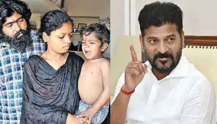 Revanth Reddy: ఆ బాలుడి చికిత్స ప్రజా ప్రభుత్వం బాధ్యత!.. సీఎం రేవంత్ రెడ్డి కీలక ఆదేశాలు