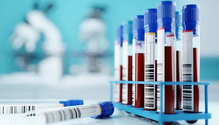 Blood samples: బ్లడ్ శాంపిల్స్ మీరే కలెక్ట్ చేయాలి.. నర్సింగ్ ఆఫీసర్లకు ఉత్తర్వులు జారీ