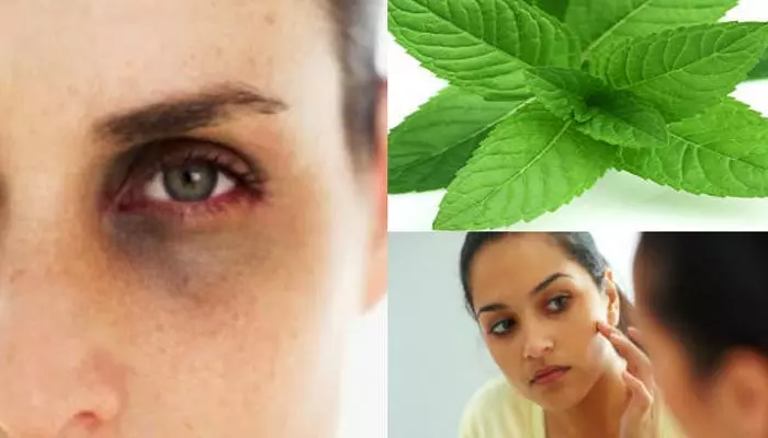 Mint leaves for dark circles : కళ్లచుట్టూ డార్క్ సర్కిల్స్‌.. పుదీనా ఆకులతో ఇలా చేస్తే చాలు !