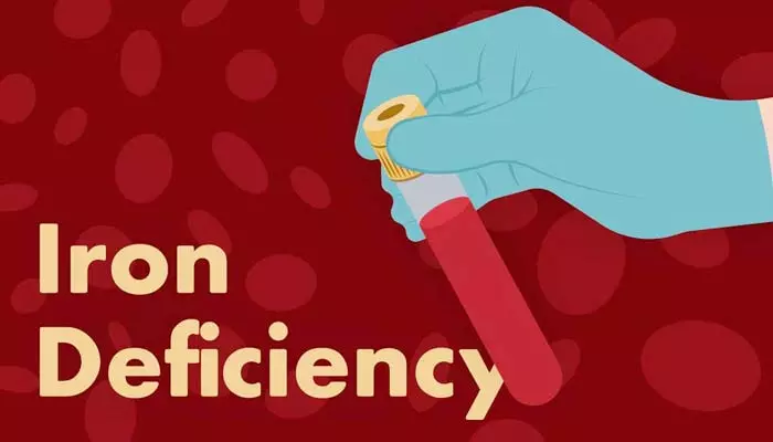 Iron deficiency: పాలకూర మాత్రమే కాదండోయ్.. ఈ ఆహారాలు తీసుకుంటే ఐరన్ లోపానికి ఇట్టే చెక్ పెట్టొచ్చు