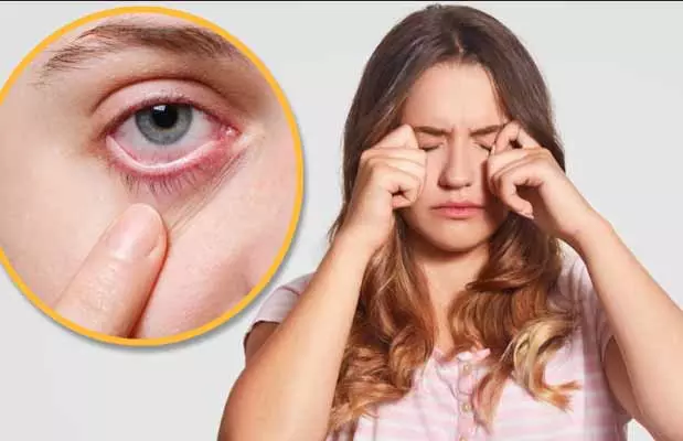 Eye Care Tips : చలికాలంలో కళ్లపై పొల్యూషన్ ఎఫెక్ట్.. వెంటనే రిలీఫ్ కోసం ఏం చేయాలంటే..