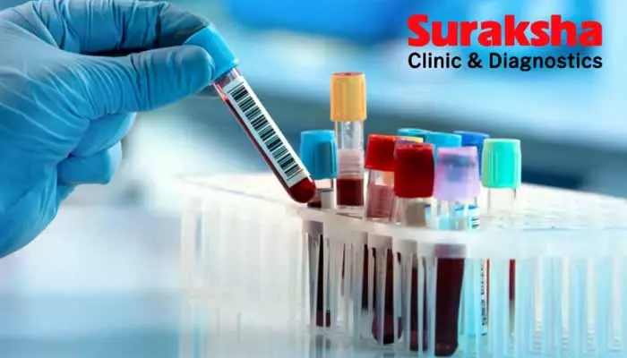 Suraksha Diagnostics IPO: నవంబర్ 29 నుంచి సురక్షా డయాగ్నొస్టిక్‌ ఐపీఓ ప్రారంభం.. ఒక్కో ఈక్విటీ షేర్ ధర ఎంతంటే..!