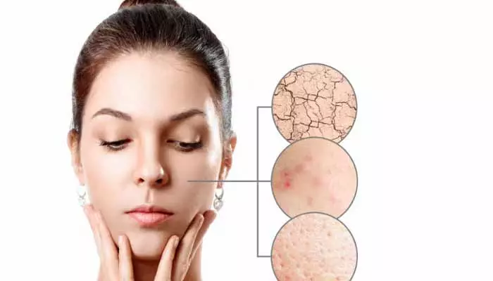 Skin care Tips: ప్యాచీ స్కిన్ పోగొట్టే బెస్ట్ రెమిడీస్..!